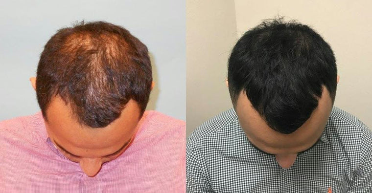 David S. before and after