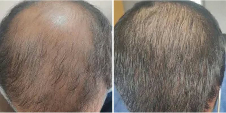 Mark S. before and after