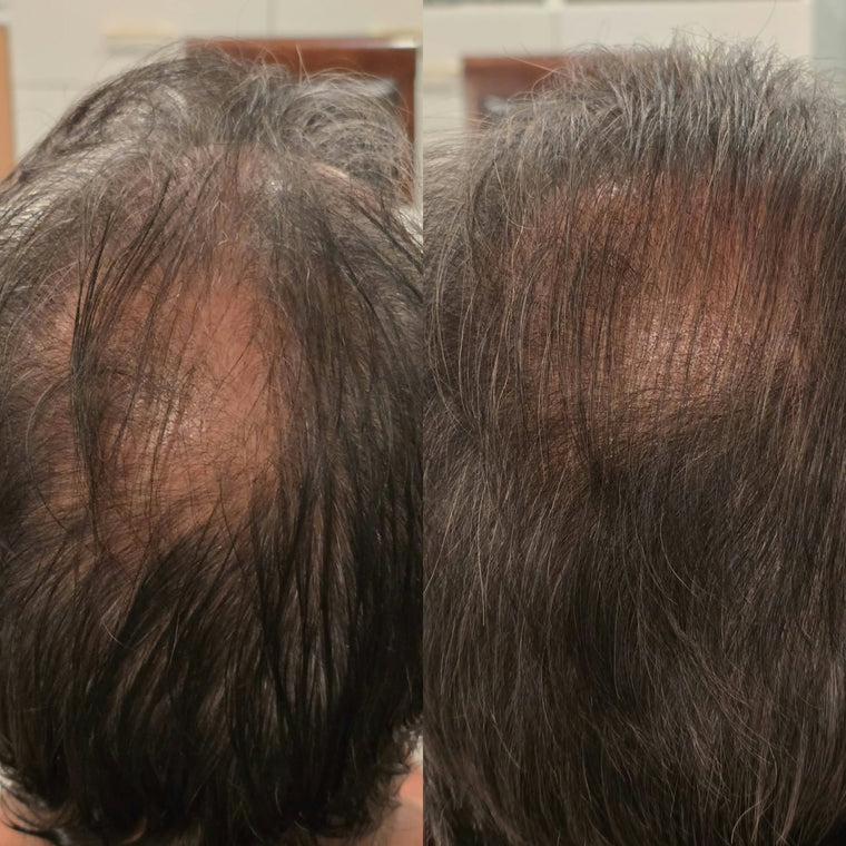 Ryan K. before and after